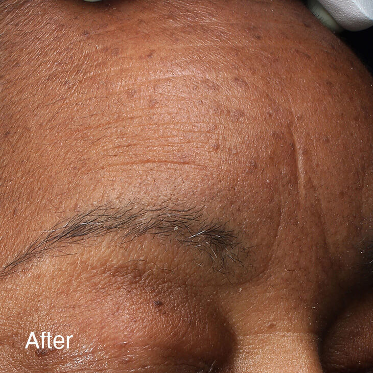 Treatment Results Patient 2 After
